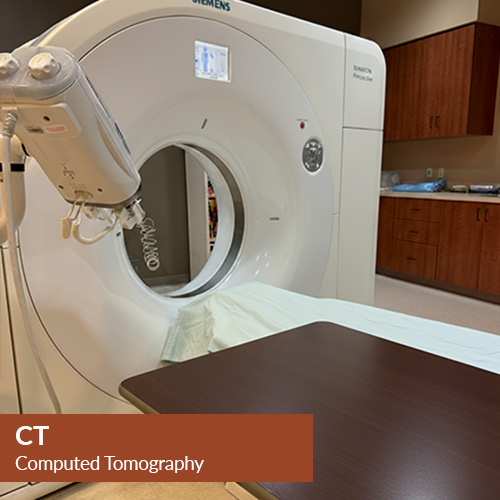 CT Scan - Computed Tomography