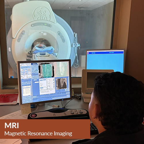 MRI - Magnetic Resonance Imaging